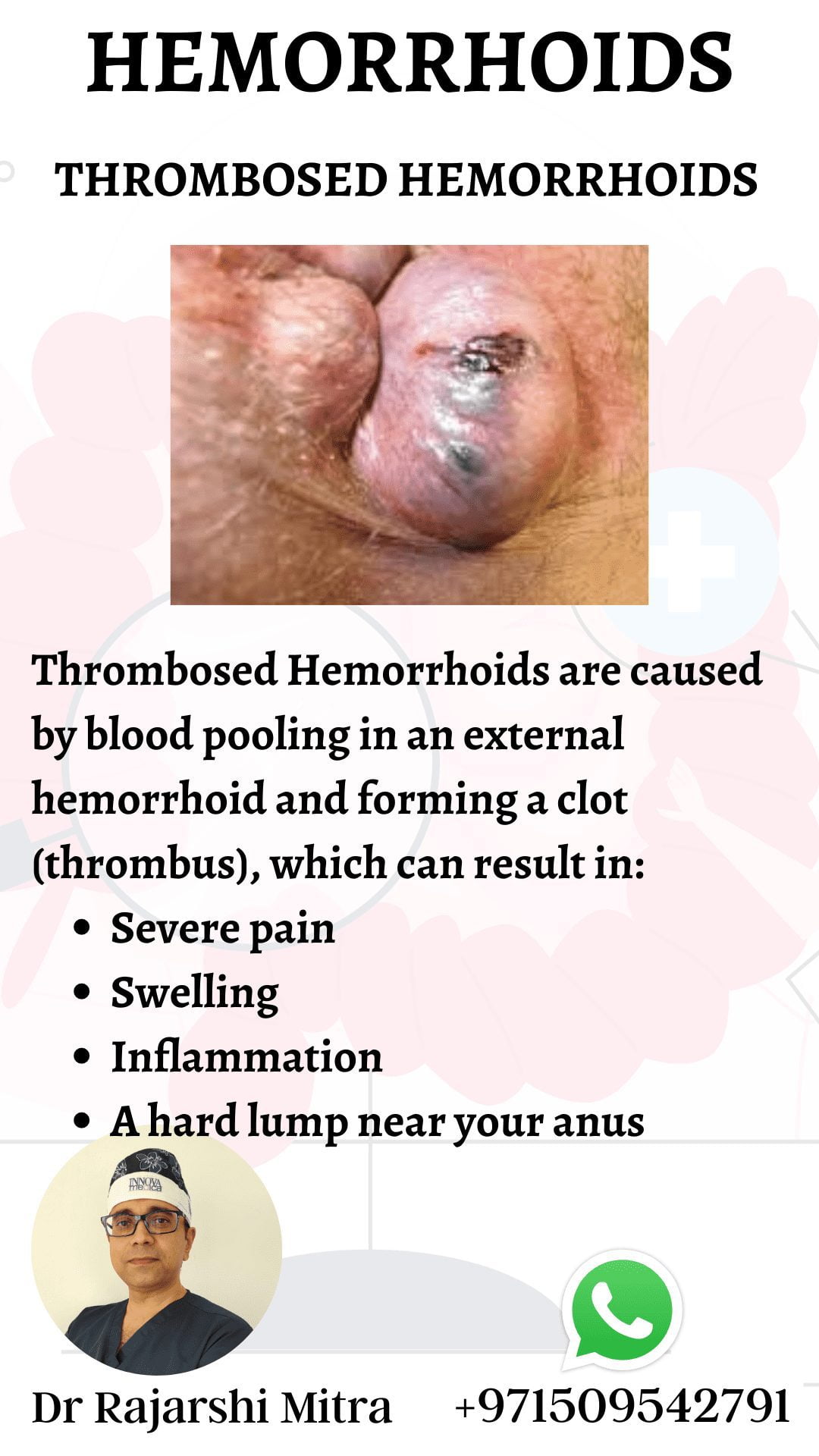 Hemorrhoids Card 11