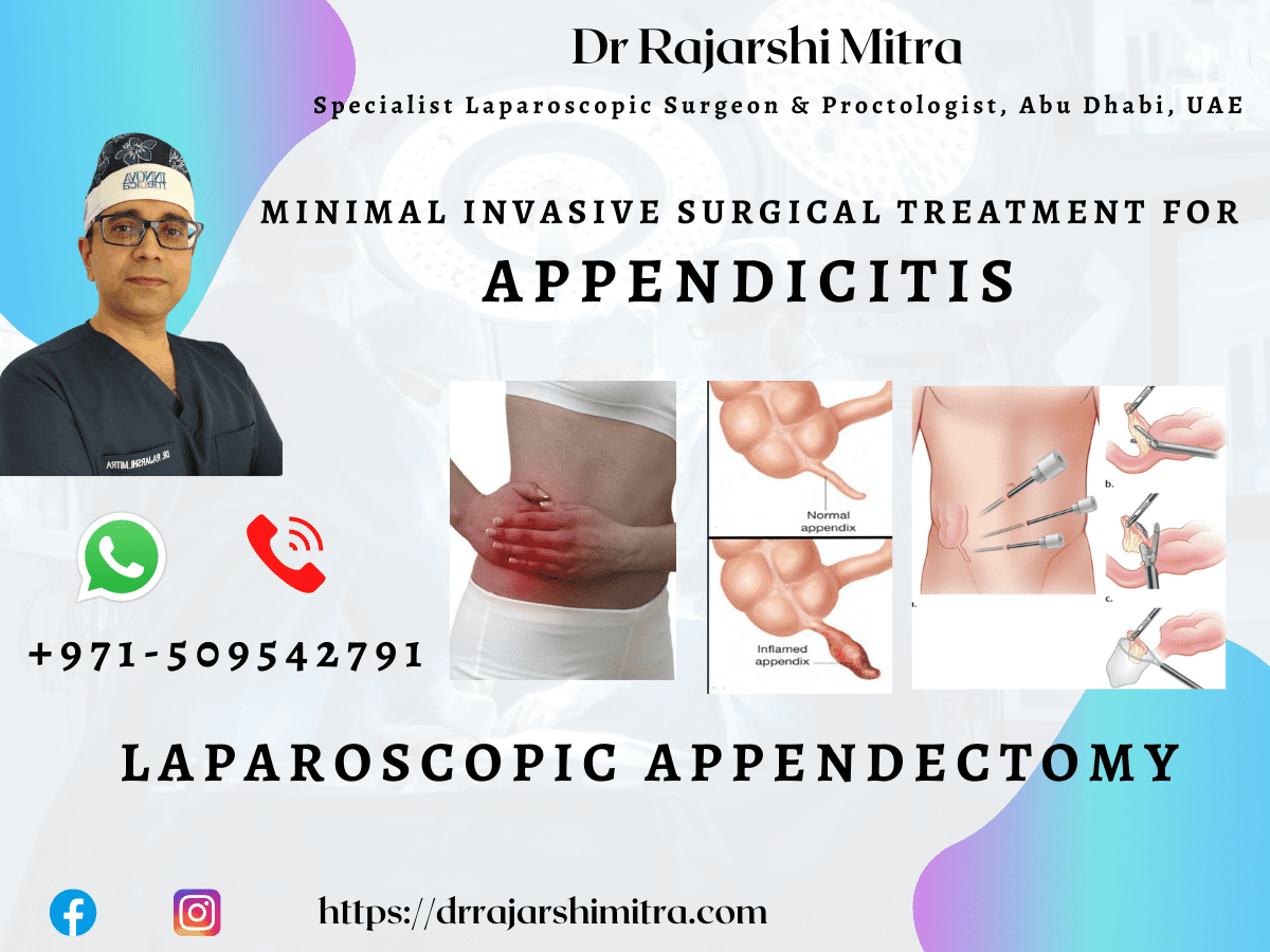 Dr Rajarshi Mitra GMB Appendicitis