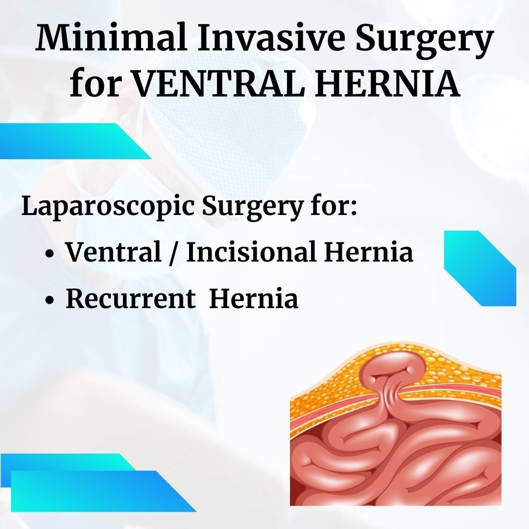 Best Surgeon for Ventral Hernia in Abu Dhabi UAE