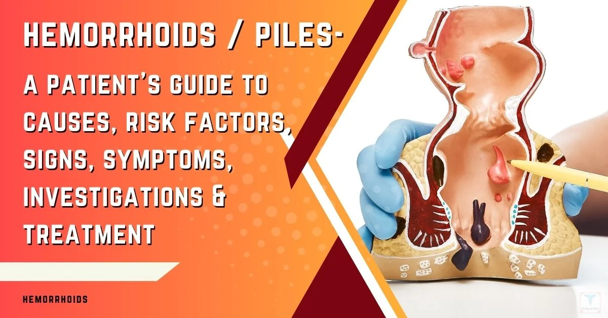 A Straight-Forward Guide to Pilonidal Cyst Prevention