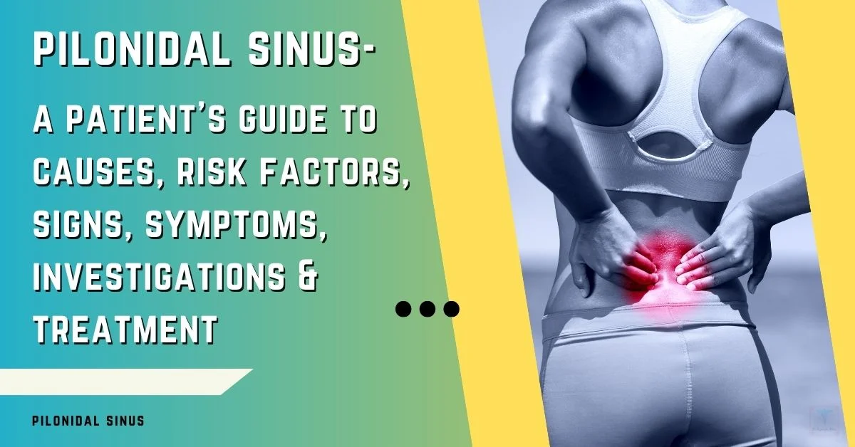 A Straight-Forward Guide to Pilonidal Cyst Prevention