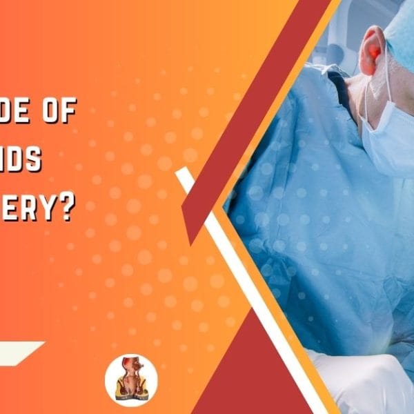 What grade of Hemorrhoids need surgery - detailed guide.