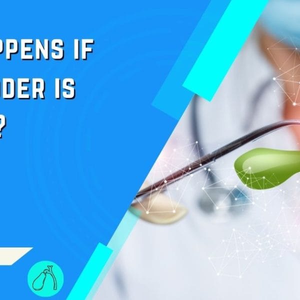 Laparoscopic GallBladder Specialist in Abu Dhabi