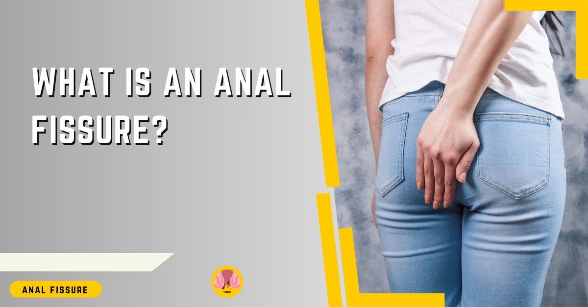Educational medical information graphic with the title 'What is an Anal Fissure?' prominently displayed at the top. The image features a person from the waist down, wearing light blue jeans. The person is standing with their back to the camera and has their right hand placed over the lower part of their buttocks, indicating discomfort in that area. There are yellow graphic elements accenting the image, and a small emblem resembling a medical alert, suggesting a focus on health information, is visible in the lower-left corner.