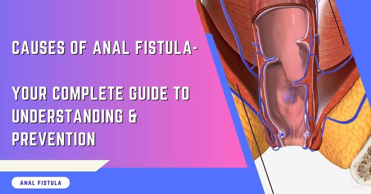 What Does An Anal Fistula Look Like