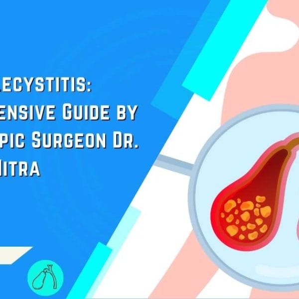 Acute Cholecystitis A Comprehensive Guide by Laparoscopic Surgeon Dr. Rajarshi Mitra