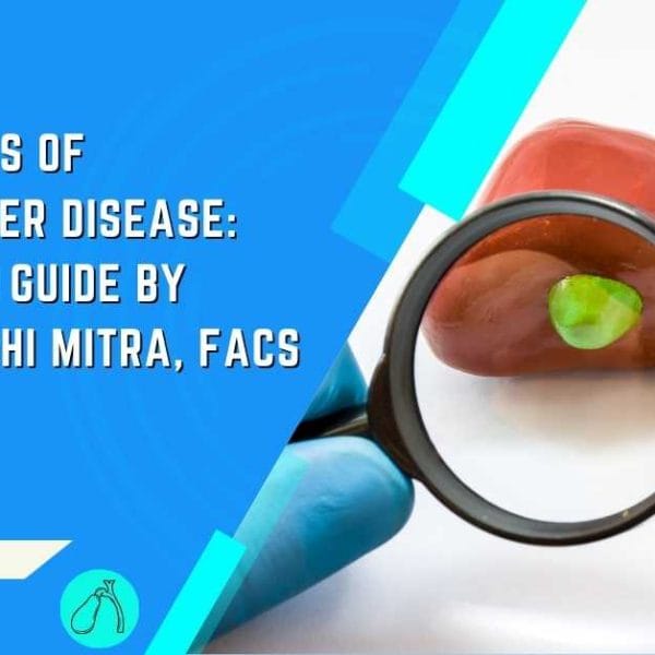 Early Signs of Gallbladder Disease A Detailed Guide by Dr. Rajarshi Mitra, FACS