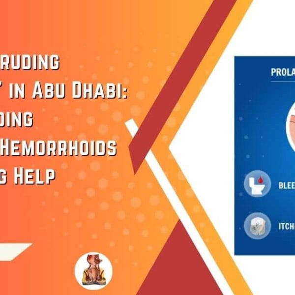 Lump Protruding from Anus in Abu Dhabi Understanding Prolapsed Hemorrhoids and Seeking Help