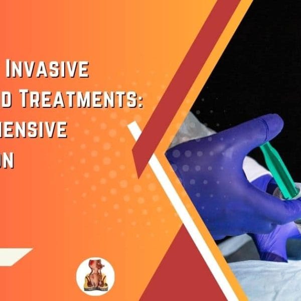 Minimally Invasive Hemorrhoid Treatments A Comprehensive Comparison